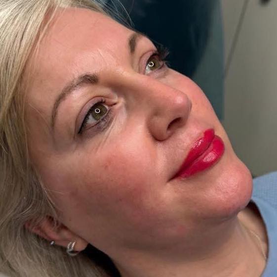 Lips example